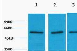 Vimentin Polyclonal Antibody