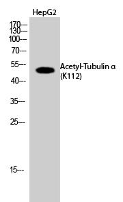 Tubulin α (Acetyl Lys112) Polyclonal Antibody