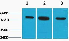 β II Tubulin Polyclonal Antibody