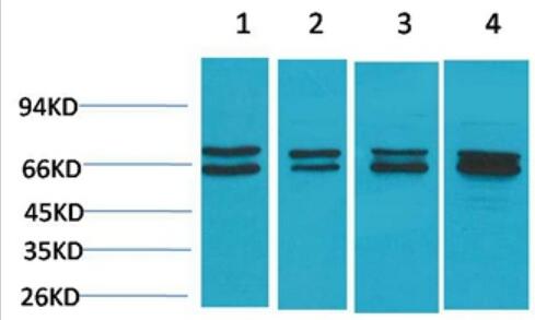 Estrogen Receptor α Polyclonal Antibody