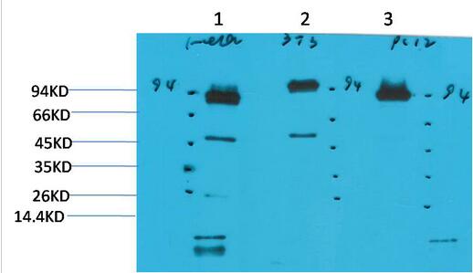 STAT3 Monoclonal Antibody