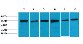 AMPKα2 Polyclonal Antibody