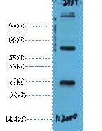 EFHD1 Polyclonal Antibody