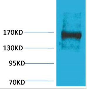EPG5 Polyclonal Antibody