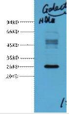 Galectin-3 Monoclonal Antibody