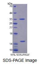 Recombinant Phosphoglucomutase 3 (PGM3)