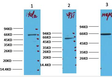 NFkB p65 Monoclonal Antibody