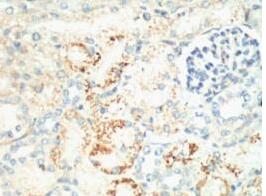 Ki 67 Monoclonal Antibody