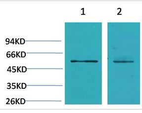 CACNB3 Polyclonal Antibody