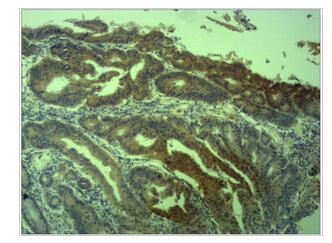 Survivin Polyclonal Antibody