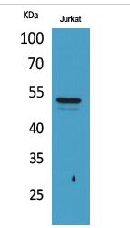 Tubulin α (Acetyl Lys40) Polyclonal Antibody