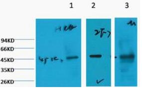 Cytokeratin 18 Monoclonal Antibody