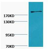 Fibronectin Monoclonal Antibody