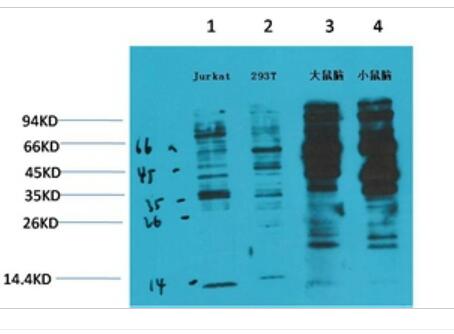 Phosphotyrosine Monoclonal Antibody