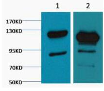 Cleaved PARP Monoclonal Antibody