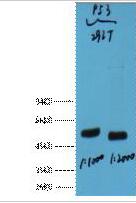 p53 Monoclonal Antibody