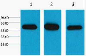 β I tubulin Monoclonal Antibody