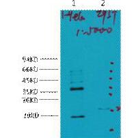 CA IX Monoclonal Antibody