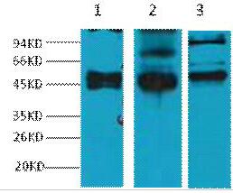 CK17 Monoclonal Antibody