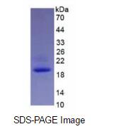 Eukaryotic Interleukin 1 Beta (IL1b)