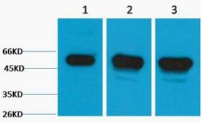 β III Tubulin Polyclonal Antibody
