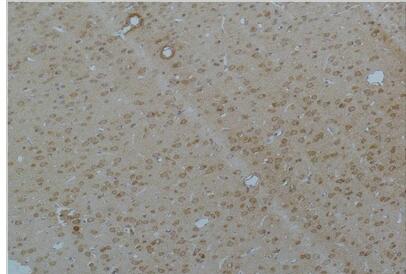 Cav pan α1 Polyclonal Antibody