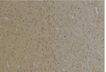 KCNK4 (TRAAK) Polyclonal Antibody