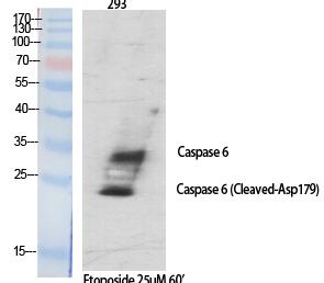 Cleaved-Caspase-6 p18 (D179) Polyclonal Antibody