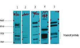 Glucocorticoid receptor Polyclonal Antibody