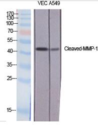 Cleaved-MMP-12 (G106) Polyclonal Antibody