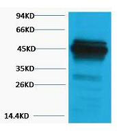 CK18 Polyclonal Antibody