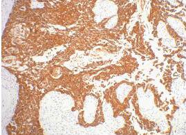 CK16 Monoclonal Antibody