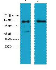 Cytokeratin 6 Monoclonal Antibody