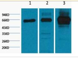 NFkB p65 Monoclonal Antibody