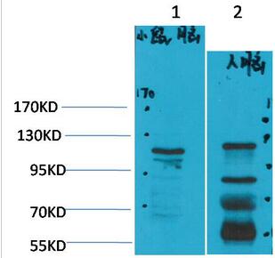CaVα2δ3 Polyclonal Antibody