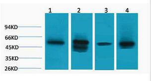 LDHD Polyclonal Antibody