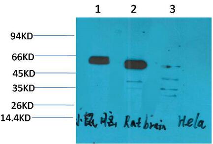 CCKBR Polyclonal Antibody