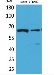 NFκB-p65 (Acetyl Lys218) Polyclonal Antibody