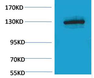 E-cadherin Polyclonal Antibody
