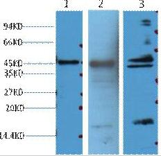 Aquaporin 4 Monoclonal Antibody