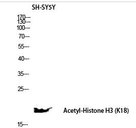 Histone H3 (Acetyl Lys18) Polyclonal Antibody