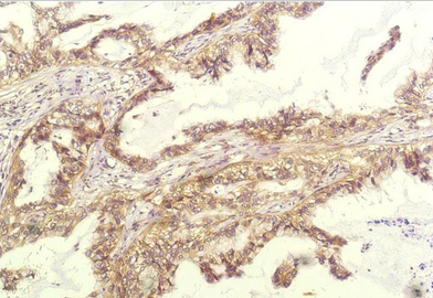 IL-8 Mouse Monoclonal Antibody(14E1)