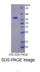 Recombinant Eukaryotic Translation Elongation Factor 1 Alpha 2 (EEF1a2)