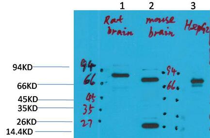 KCNN2 (SK2) Polyclonal Antibody