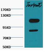 Cleaved PARP Monoclonal Antibody