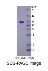 Recombinant Phosphoglucomutase 3 (PGM3)