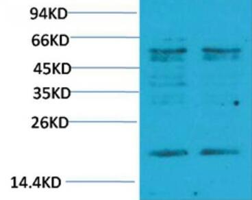 TNF α Polyclonal Antibody