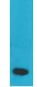 TNF α Monoclonal Antibody