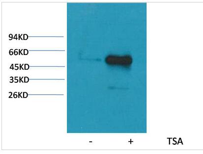 α-tubulin (Acetyl Lys40) Monoclonal Antibody(4A8)