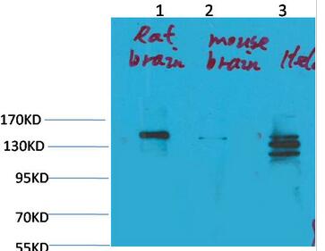 SLC12A4 Polyclonal Antibody